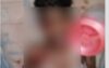 আতশবাজির আগুনে ঝলসে গেল যুবকের হাত-চোখ