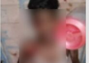আতশবাজির আগুনে ঝলসে গেল যুবকের হাত-চোখ