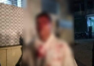 বাকেরগঞ্জে আনসার সদস্যের উপর হামলা