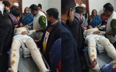 ভোটের পর উপজেলা চেয়ারম্যানের হাত-পা ভেঙে দিলো প্রতিপক্ষ