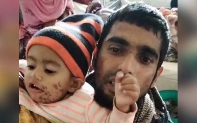 বরিশালে বাবা-মাসহ ‘অ্যাসিড’ সন্ত্রাসের শিকার হলো ১৮ মাসের শিশু