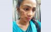 মাদারীপুরে কিশোরীকে সৎ মায়ের গরম খুন্তির ছ্যাঁকা