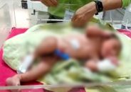 পটুয়াখালীতে ঝোপের ভেতরে মিললো জীবিত নবজাতক