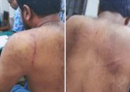 বাকেরগঞ্জে মুক্তিযোদ্ধা ওপর সন্ত্রাসী হামলা, আহত ২