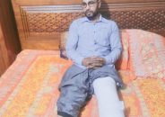 সড়ক দুর্ঘটনায় হাঁটুর বাটি ভেঙ্গে গেছে, আলহামদুলিল্লাহ এখন ভালো আছি: মোজাম্মেল হোসেন মোহন