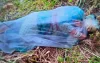 বরিশালে পলিথিনে মোড়ানো এসিডদগ্ধ নারীকে জীবিত উদ্ধার