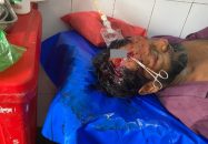 গৌরনদীতে ধান খাওয়া কেন্দ্র করে প্রতিপক্ষের হামলায় আহত -২