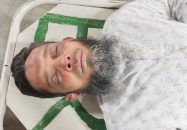 বরিশালে বিএনপি নেতার হামলায় জামায়াত নেতা আহত