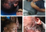 কাজিরহাটে বিএনপি কর্মীদের হামলায় ৬ জামায়াতকর্মী আহত, ১জন গুরুতর