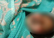 বাবুগঞ্জে কুপ্রস্তাবে রাজি না হওয়ায় কিশোরীর গায়ে আগুন দিয়ে হত্যা