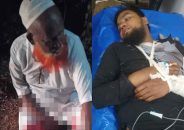 রাজাপুরে জামায়াতের দুই কর্মীকে কুপিয়ে জখম