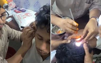 পুলিশের ভয়ে কানের ভেতর ইয়াবা, ৯ দিন পর অস্ত্রোপচার