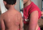 বাকেরগঞ্জে পড়া না পারায় মাদ্রাসা শিক্ষার্থীকে বেধড়ক পেটালেন শিক্ষক
