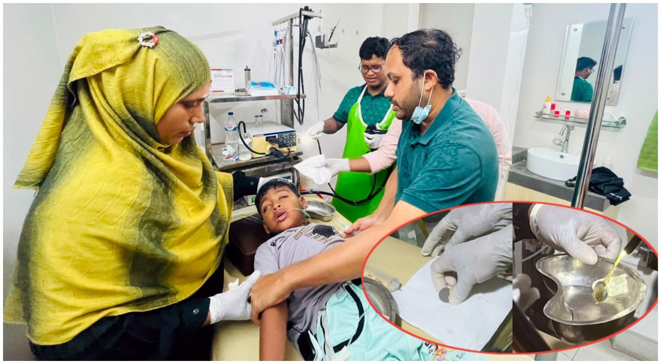 ৭ বছরের শিশুর পাকস্থলী থেকে ৫ টাকার কয়েন উদ্ধার