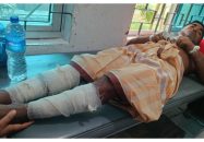 মনপুরায় ইউপি সদস্যকে পিটিয়ে হাত-পা ভেঙে দিল দুর্বৃত্তরা