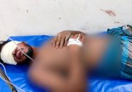 বোরহানউদ্দিনে গভীর রাতে যুবকের দুই চোখ উপড়ে ফেলার অভিযোগ